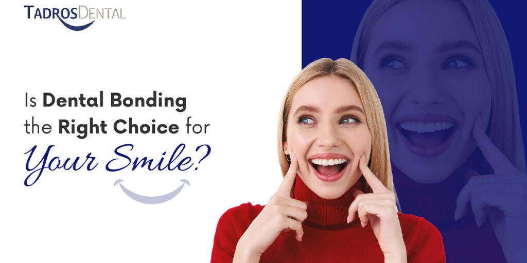 Is Dental Bonding the Right Choice for Your Smile?