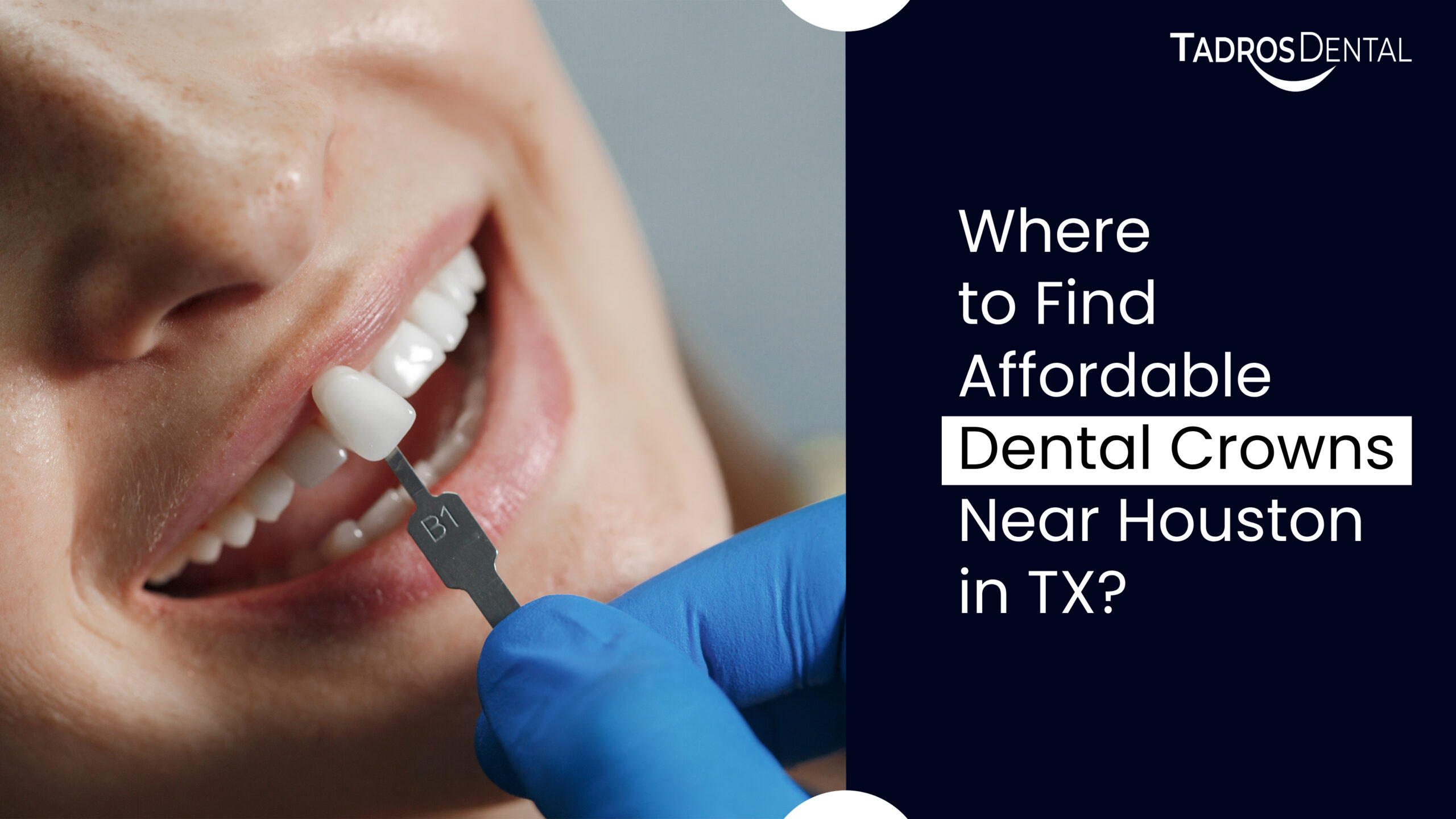 Where to Find Affordable Dental Crowns Near Houston in TX?