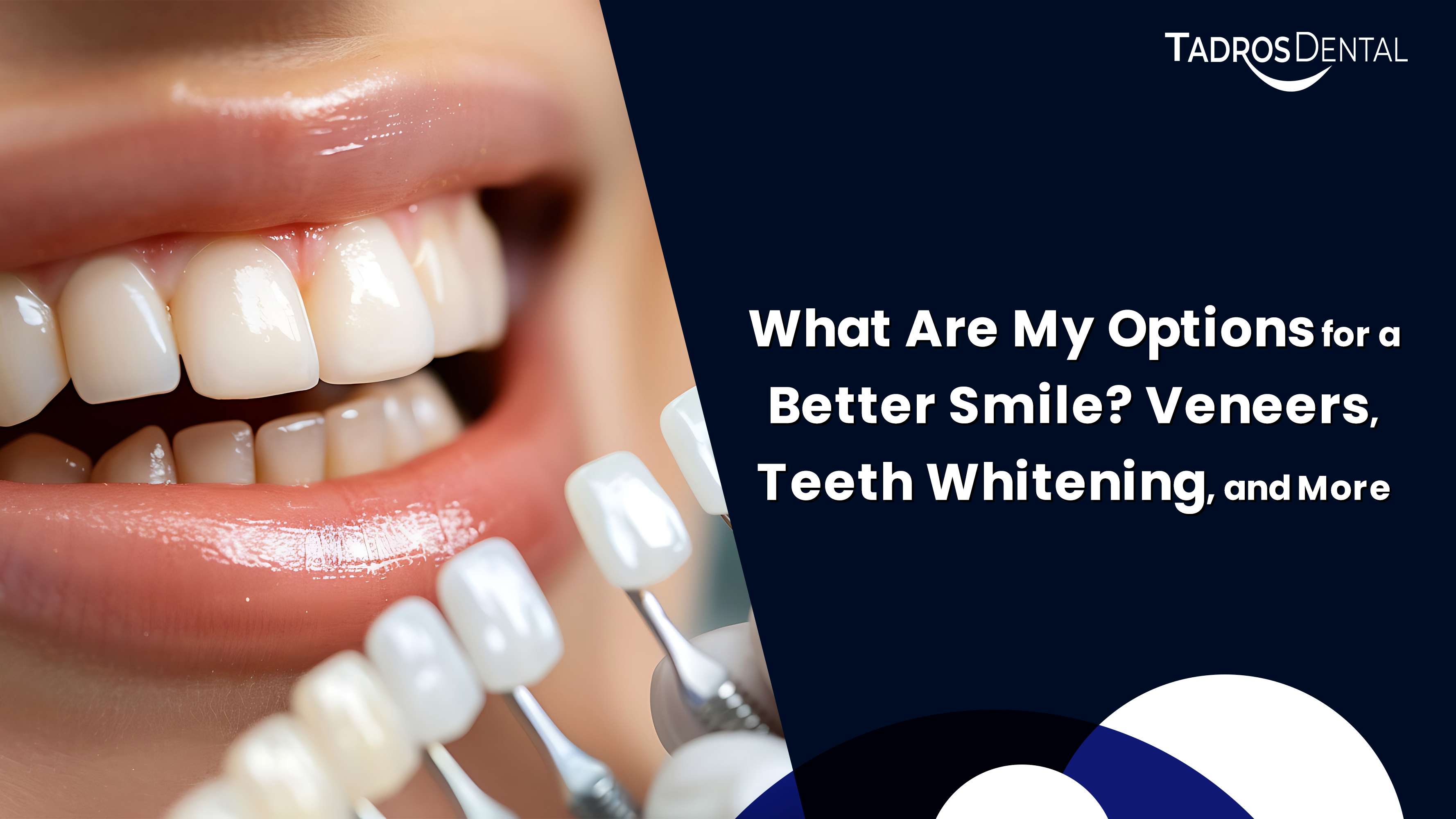 Teeth Whitening