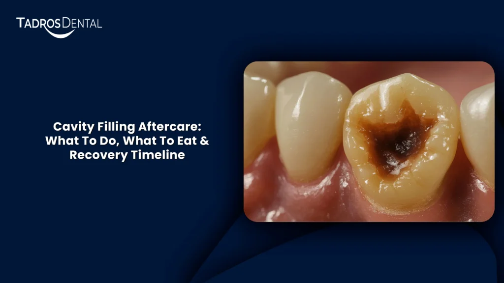 Cavity Filling Aftercare: What To Do, What To Eat & Recovery Timeline