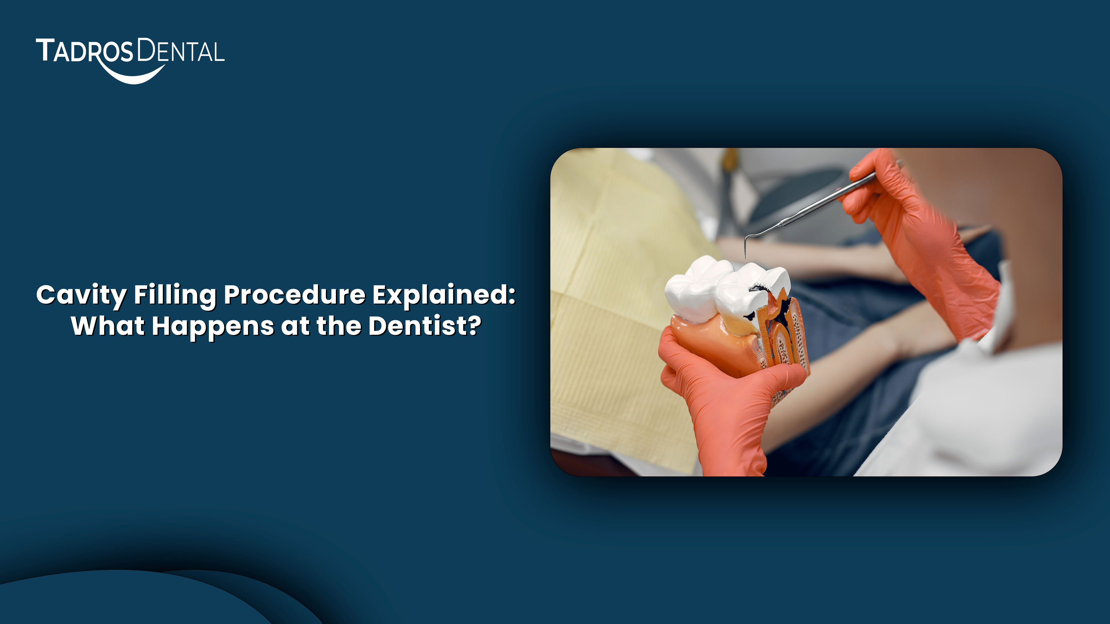 Step-by-step cavity filling procedure at the dentist