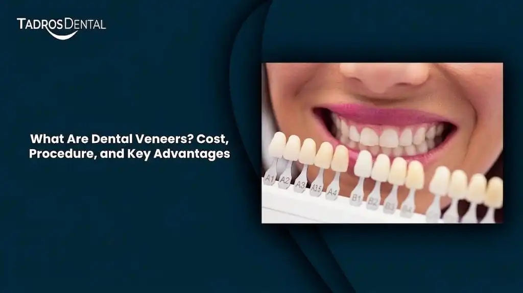 What Are Dental Veneers? Cost, Procedure, and Key Advantages