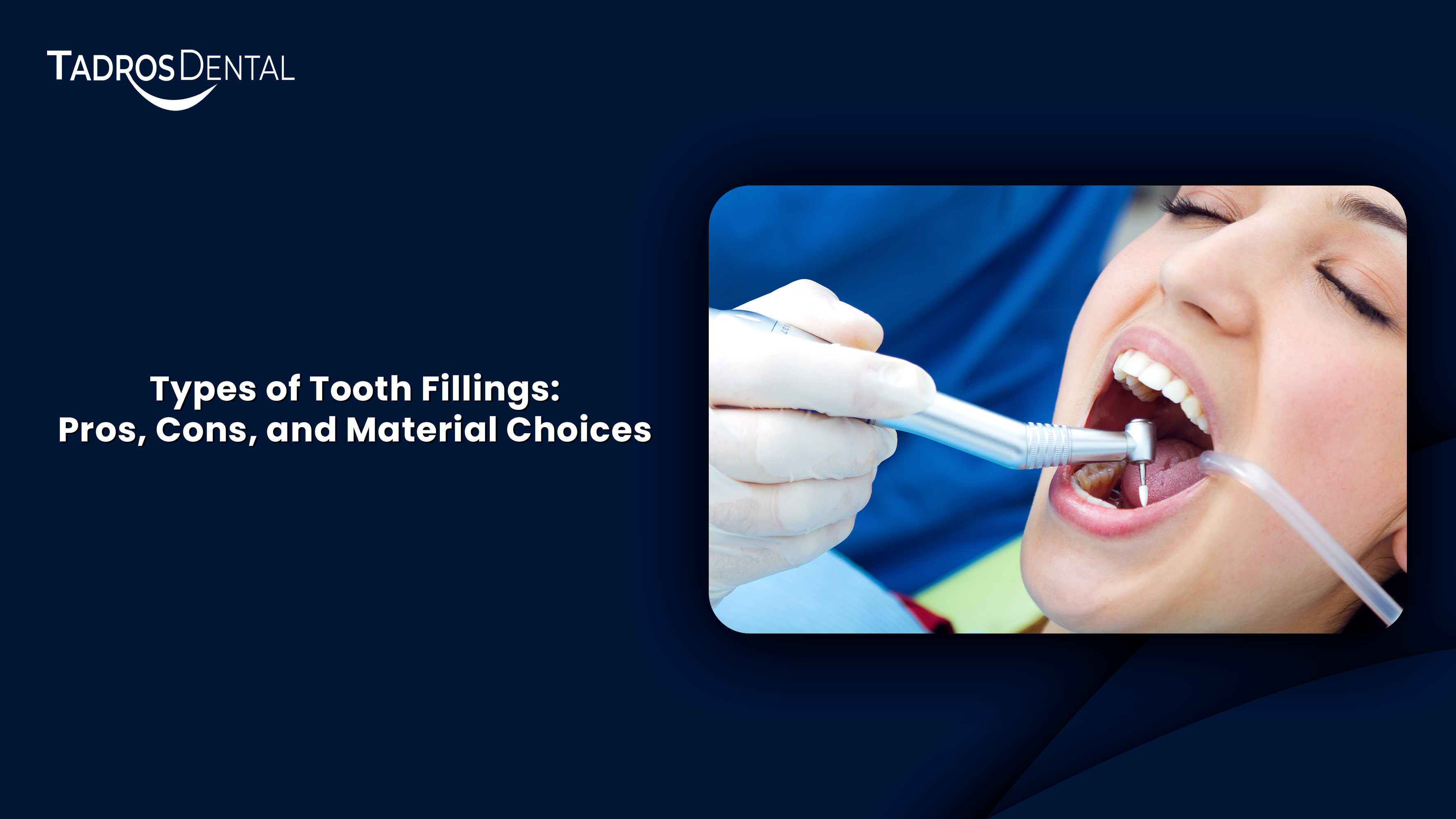 types of tooth fillings