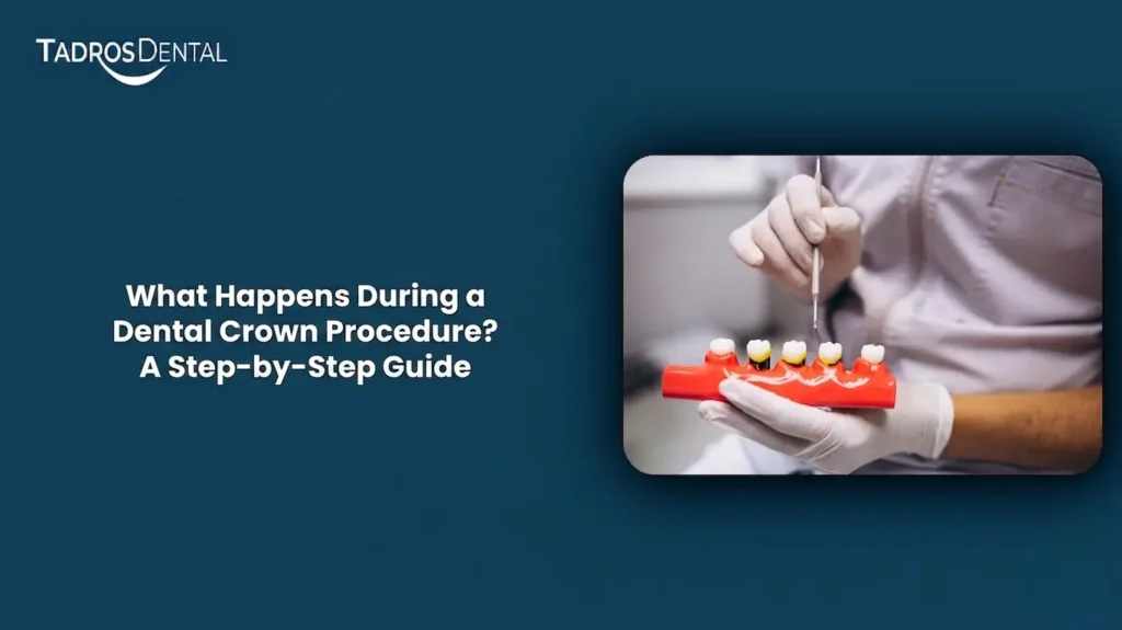 What Happens During a Dental Crown Procedure? A Step-by-Step Guide