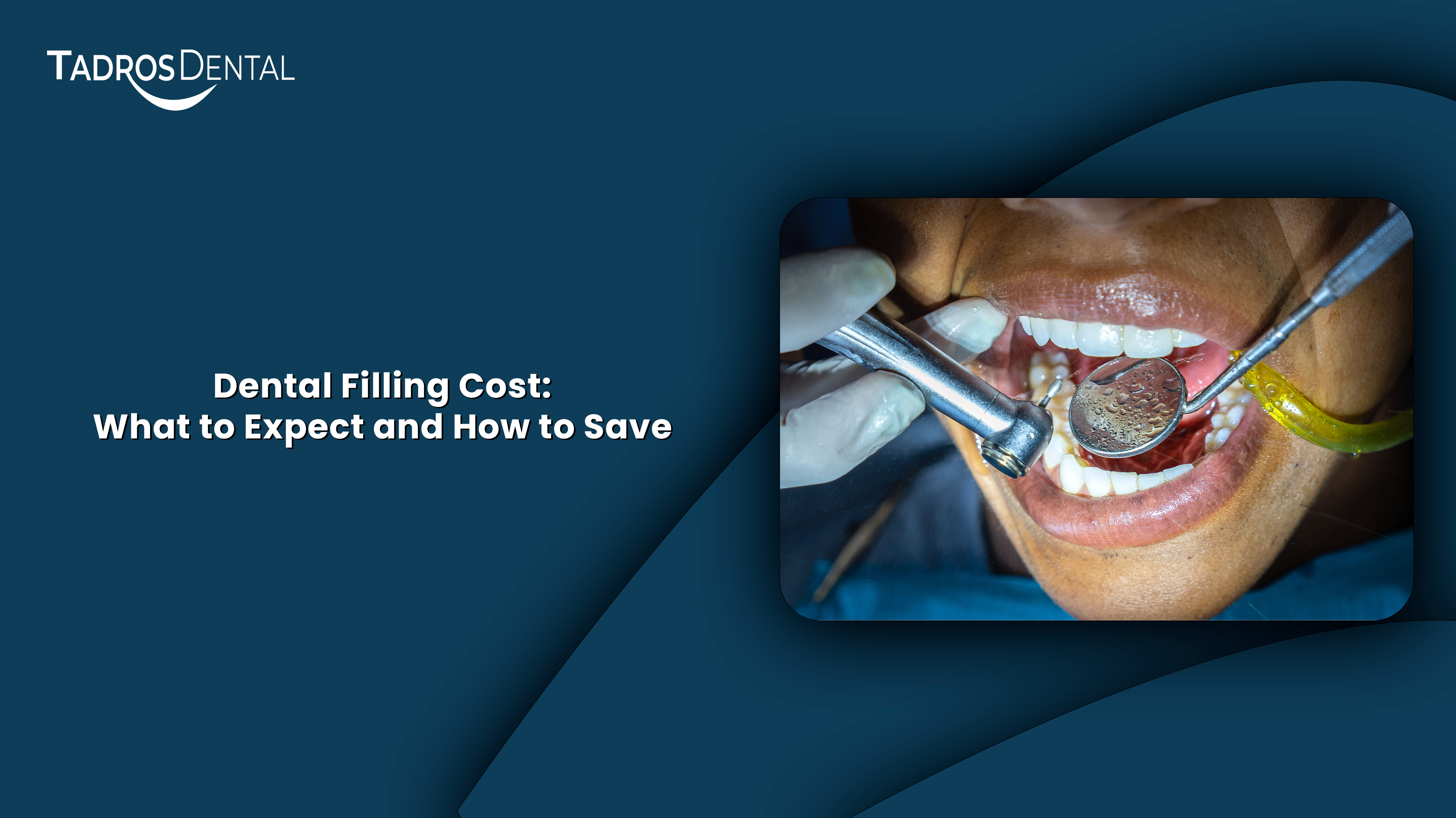 Dental Filling Cost: What to Expect and How to Save