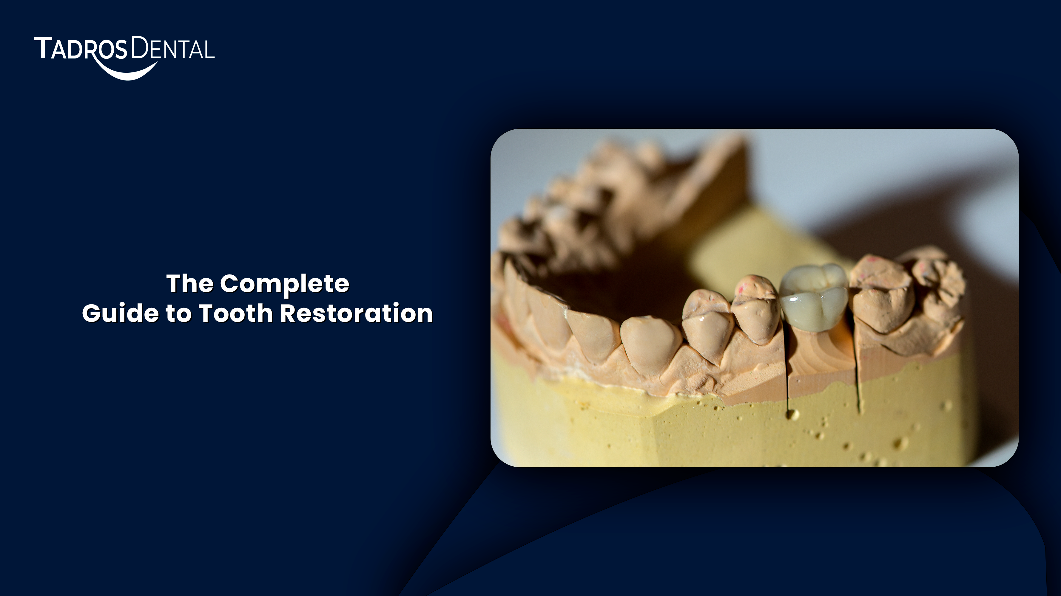 The Complete Guide to Tooth Restoration