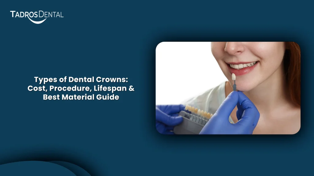 Types of Dental Crowns: Cost, Procedure, Lifespan & Best Material Guide