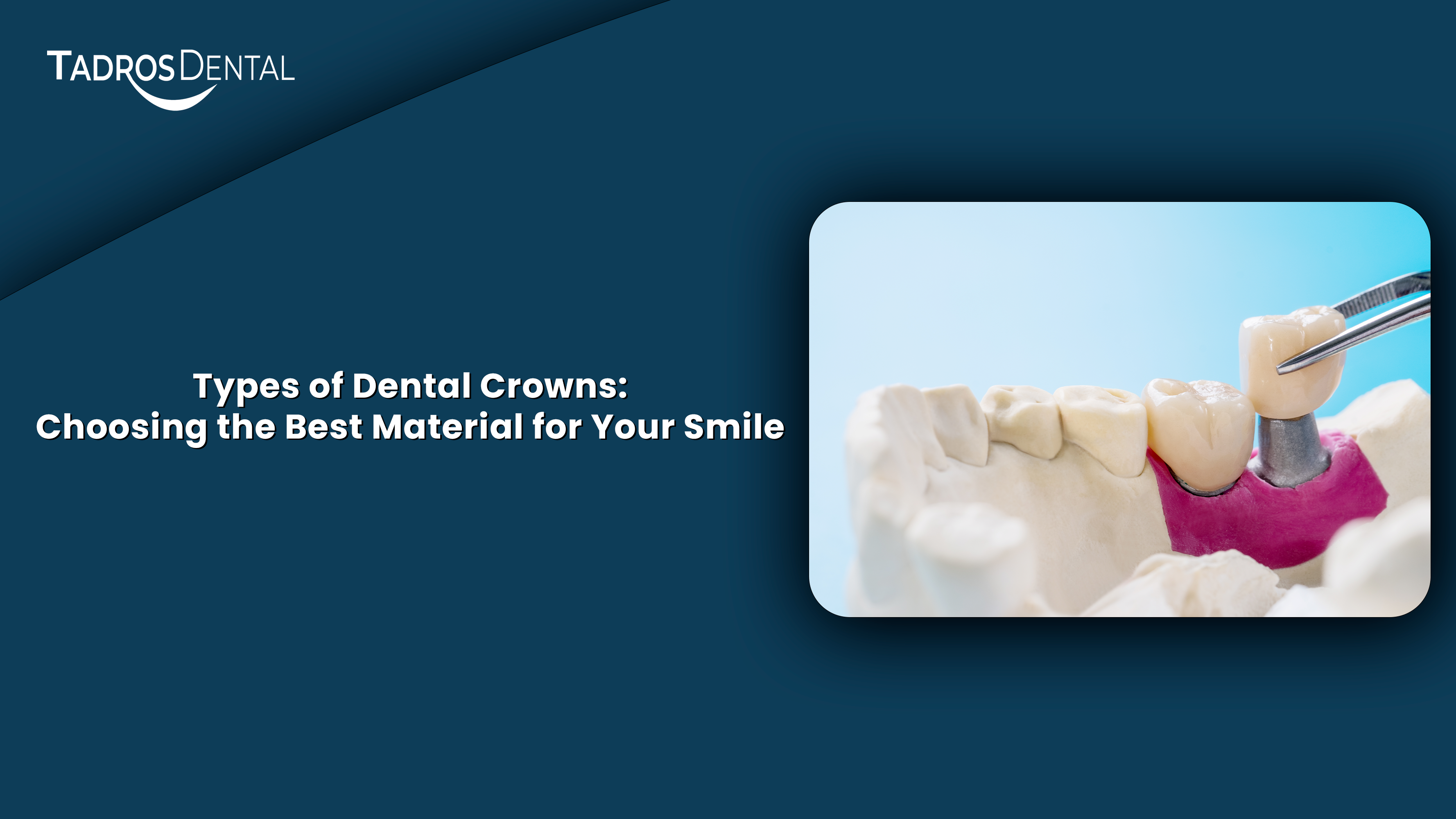 Dentist showing patient different types of dental crowns