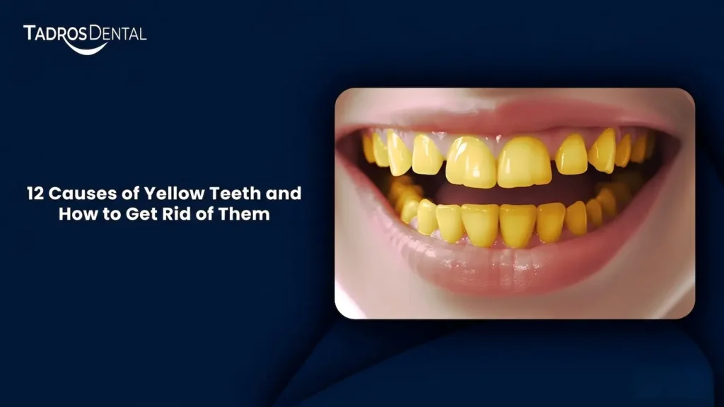 12 Causes of Yellow Teeth and How to Get Rid of Them