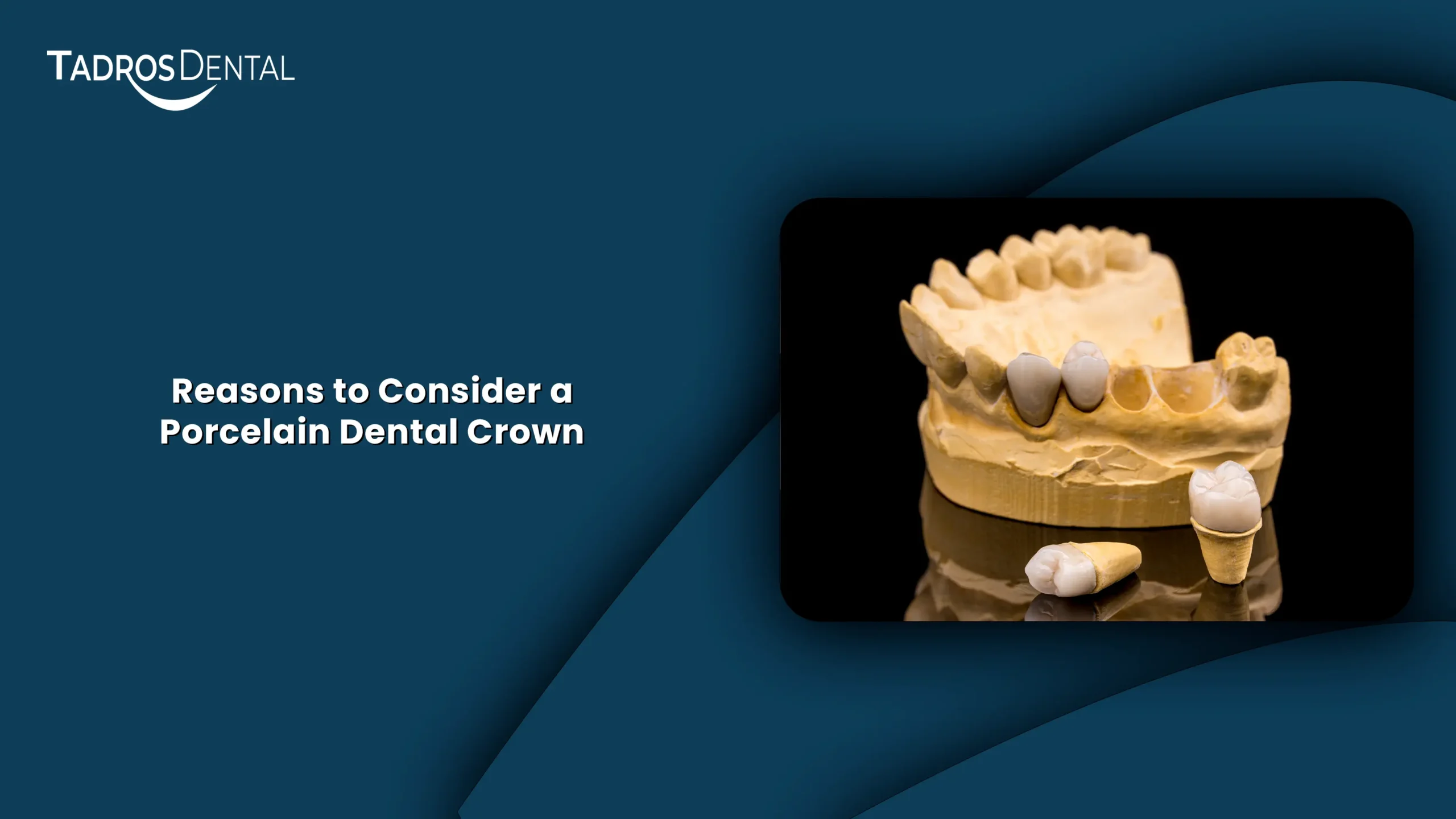 Reasons to Consider a Porcelain Dental Crown