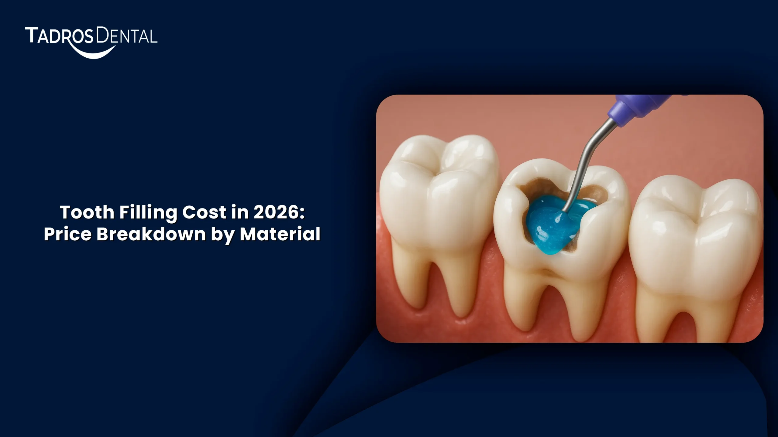 Tooth Filling Cost in 2026