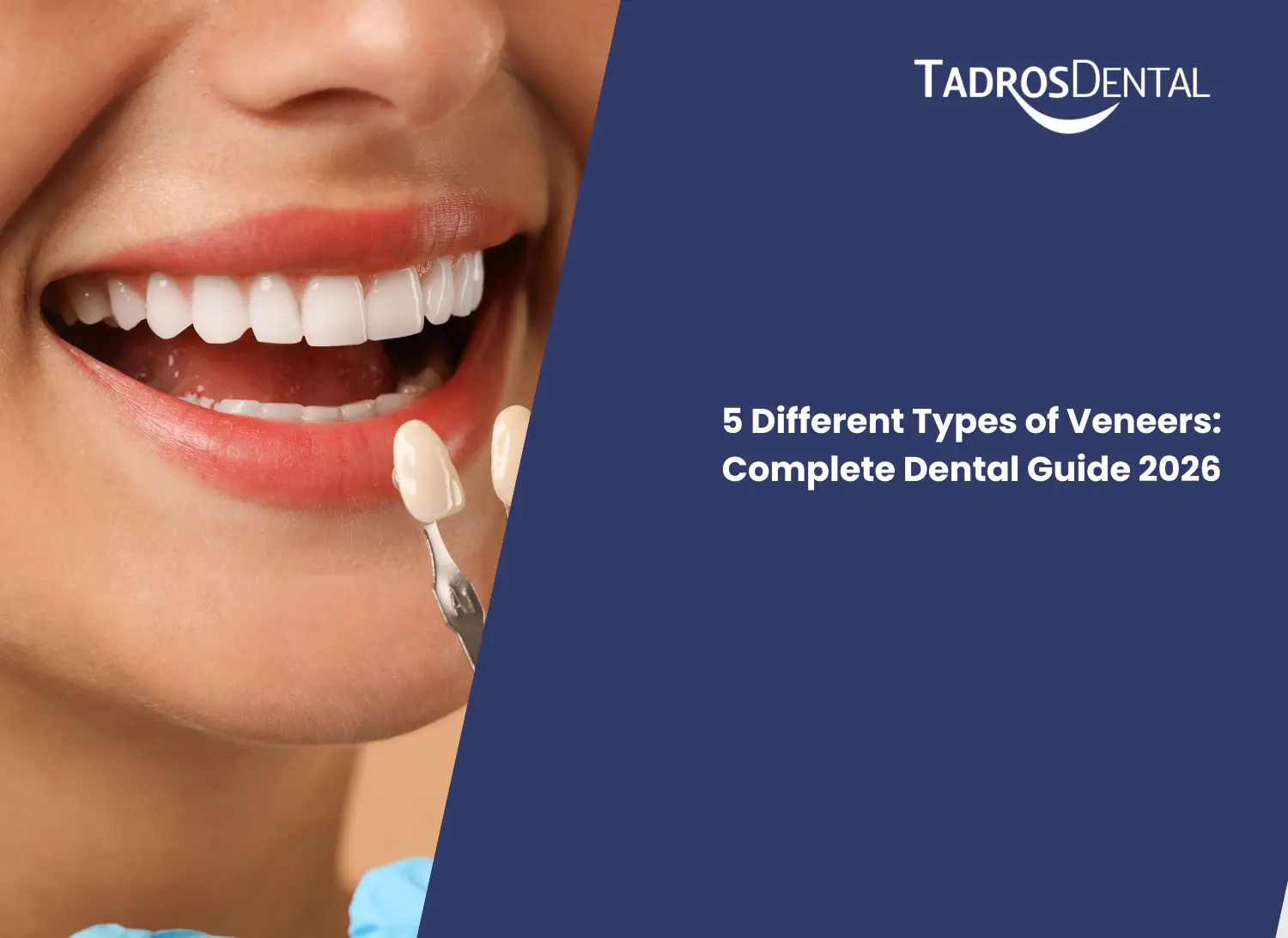 5 Different Types of Veneers_ Complete Dental Guide 2026