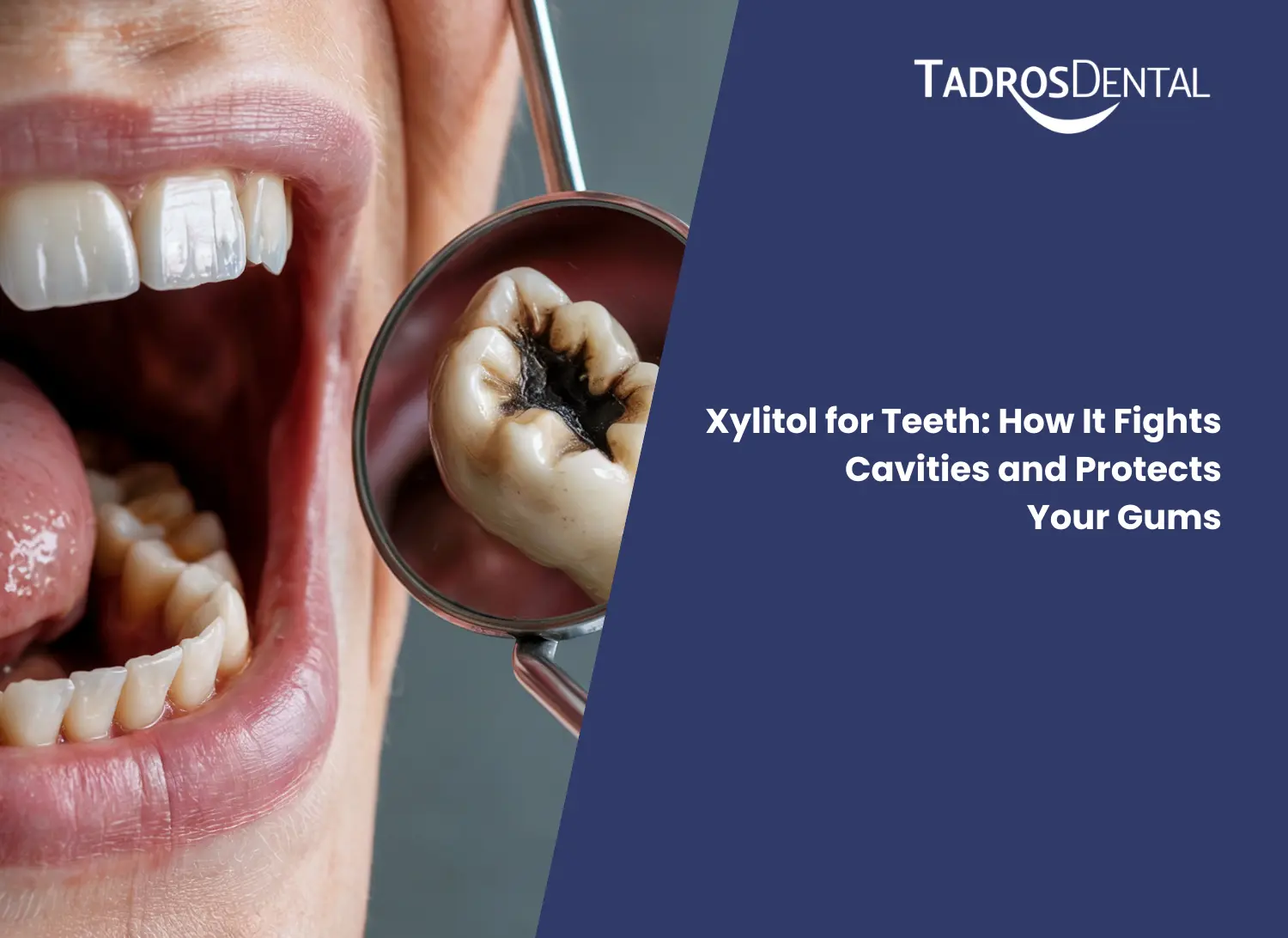 Xylitol for Teeth_ How It Fights Cavities and Protects Your Gums