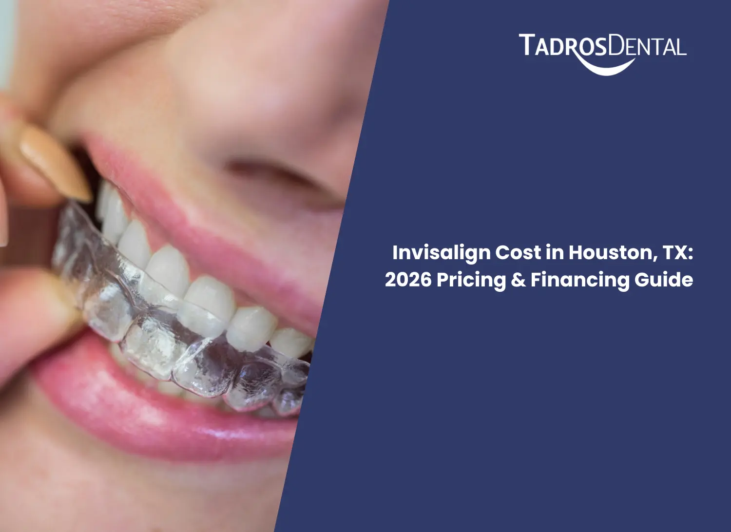Invisalign Cost in Houston, TX_ 2026 Pricing & Financing Guide